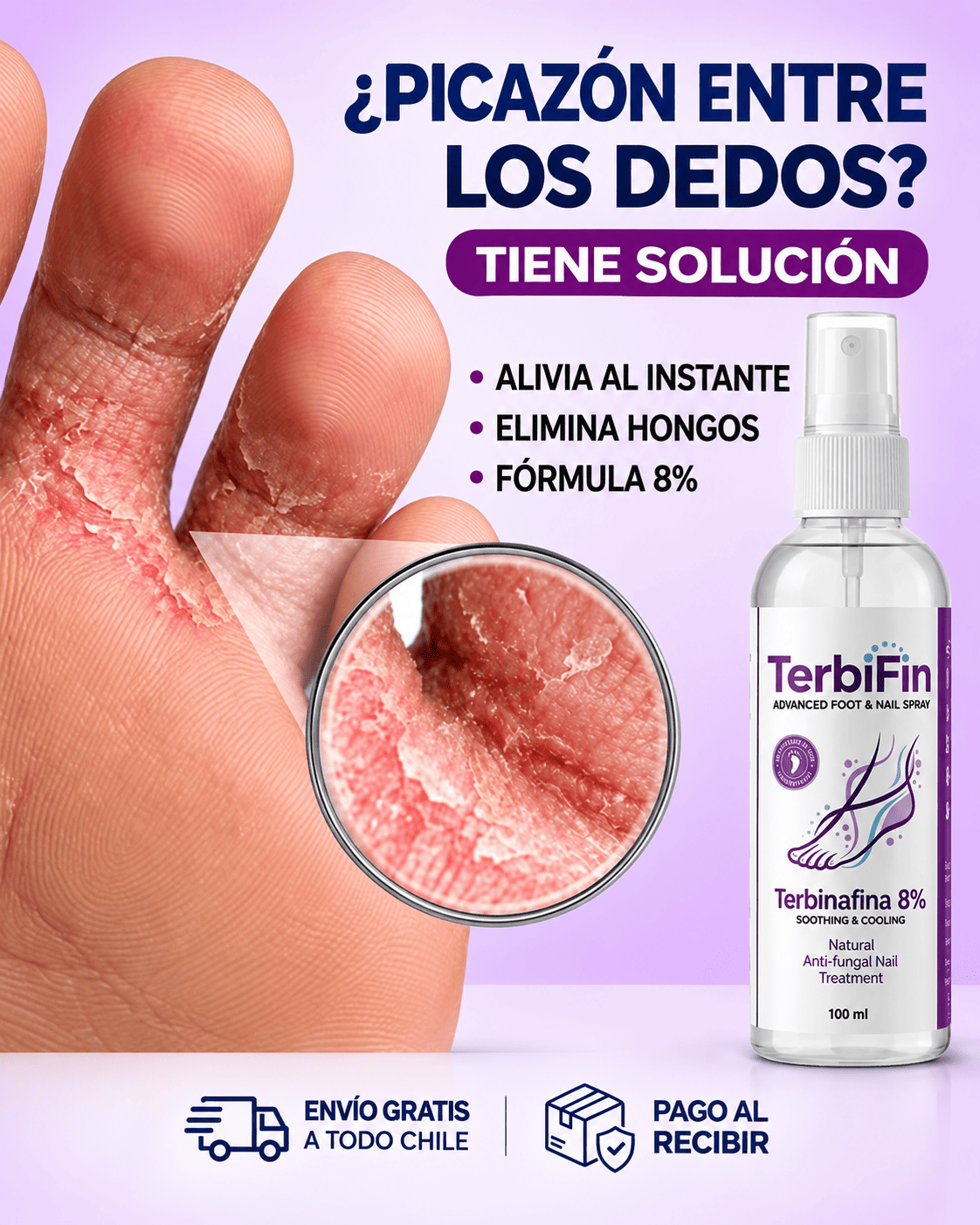TerbiFin® Spray Antihongos — Resultados Visibles en 7 Días