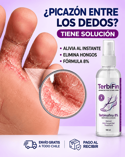 TerbiFin® Spray Antihongos — Resultados Visibles en 7 Días
