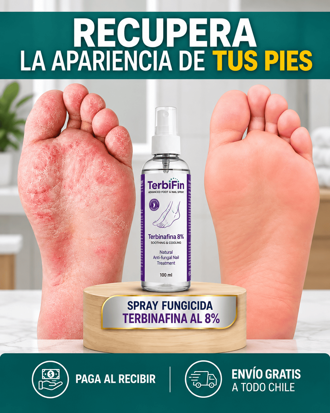 TerbiFin® Spray Antihongos — Resultados Visibles en 7 Días