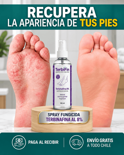 TerbiFin® Spray Antihongos — Resultados Visibles en 7 Días